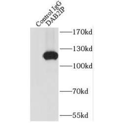 DAB2 Interacting Protein (DAB2IP) Antibody