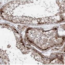 DAN Domain Family Member 5 (DAND5) Antibody