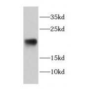 WB analysis of human heart tissue, using DAND5 antibody (1/400 dilution).