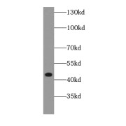 WB analysis of A431 cells, using DAPK2-Specific antibody (1/200 dilution).