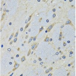 Aspartate-tRNA Ligase, Cytoplasmic (DARS) Antibody