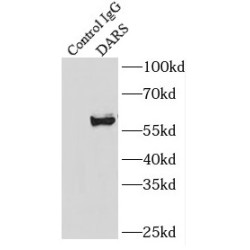 Aspartate-tRNA Ligase, Cytoplasmic (DARS) Antibody