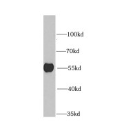 WB analysis of MCF7 cells, using DARS antibody (1/1000 dilution).