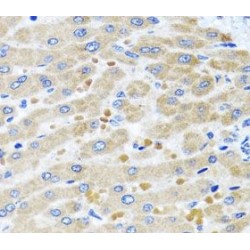 Aspartate-tRNA Ligase, Mitochondrial (DARS2) Antibody