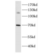 WB analysis of Y79 cells, using DAXX antibody (1/1500 dilution).