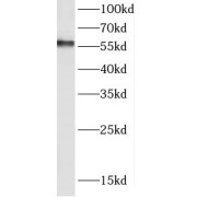 WB analysis of mouse testis tissue, using DAZ4 antibody (1/600 dilution).