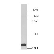 WB analysis of A431 cells, using DBI antibody (1/1000 dilution).