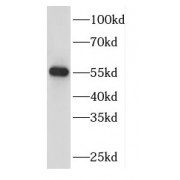 WB analysis of mouse brain tissue, using DBNL antibody (1/1000 dilution).