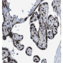 Lariat Debranching Enzyme (DBR1) Antibody