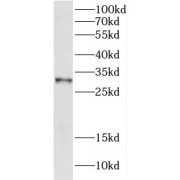 WB analysis of HEK-293 cells, using DCI antibody (1/600 dilution).