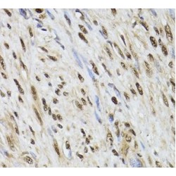 Deoxycytidine Kinase (DCK) Antibody