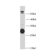 WB analysis of mouse liver tissue, using DCK antibody (1/1000 dilution).