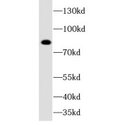 WB analysis of rat brain tissue, using DCLK1 antibody (1/1000 dilution).