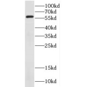 WB analysis of Jurkat cells, using DCLRE1B antibody (1/800 dilution).