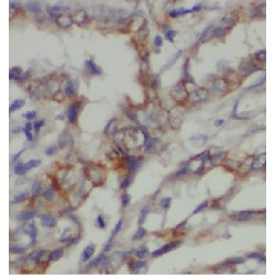 mRNA-Decapping Enzyme 1A (DCP1A) Antibody