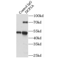 mRNA-Decapping Enzyme 1A (DCP1A) Antibody