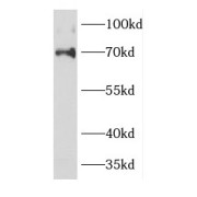 WB analysis of mouse lung tissue, using DCP1A antibody (1/1000 dilution).