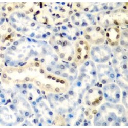 Deoxycytidylate Deaminase (DCTD) Antibody