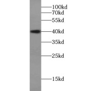 WB analysis of human brain tissue, using DCX antibody (1/600 dilution).