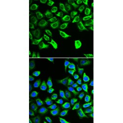 Dimethylarginine Dimethylaminohydrolase 2 (DDAH2) Antibody