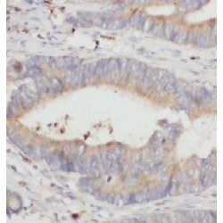 Dimethylarginine Dimethylaminohydrolase 2 (DDAH2) Antibody