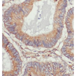 Damage Specific DNA Binding Protein 1 (DDB1) Antibody