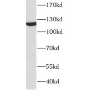 WB analysis of HeLa cells, using DDB1 antibody (1/1000 dilution).