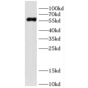 WB analysis of HeLa cells, using DDB2 antibody (1/1000 dilution).