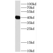 WB analysis of mouse liver tissue, using DDRGK1 antibody (1/600 dilution).