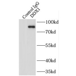 ATP-Dependent RNA Helicase DDX1 (DDX1) Antibody