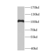 WB analysis of HeLa cells, using DDX1 antibody (1/1000 dilution).