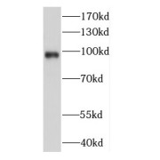 WB analysis of K-562 cells, using DDX23 antibody (1/1000 dilution).