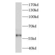 WB analysis of A549 cells, using DDX28 antibody (1/300 dilution).