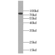 WB analysis of mouse testis tissue, using DDX4, VASA antibody (1/800 dilution).