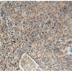 DEAD (Asp-Glu-Ala-Asp) Box Polypeptide 43 (DDX43) Antibody