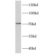 WB analysis of HeLa cells, using DDX43 antibody (1/800 dilution).