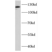 WB analysis of HEK-293 cells, using DDX46 antibody (1/500 dilution).