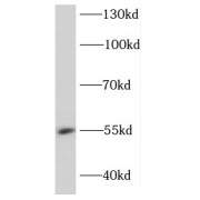 WB analysis of HeLa cells, using DDX49 antibody (1/600 dilution).