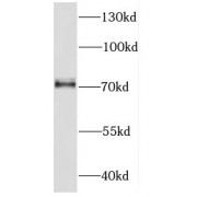 WB analysis of K-562 cells, using DDX51 antibody (1/300 dilution).