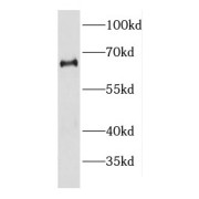 WB analysis of HepG2 cells, using DDX56 antibody (1/1000 dilution).