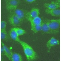 Antiviral Innate Immune Response Receptor RIG-I (RIGI) Antibody