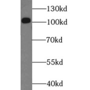 WB analysis of HepG2 cells, using DDX58 antibody (1/1000 dilution).