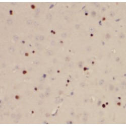 Death Effector Domain Containing 2 (DEDD2) Antibody