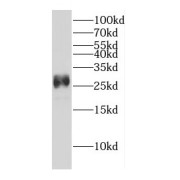 WB analysis of HeLa cells, using DENR antibody (1/2000 dilution).