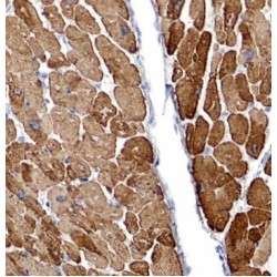 Desmin (DES) Antibody