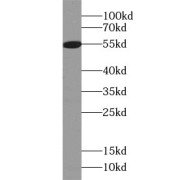 WB analysis of mouse lung tissue, using DFNA5 antibody (1/1000 dilution).