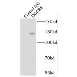 DiGeorge Syndrome Critical Region Gene 8 (DGCR8) Antibody