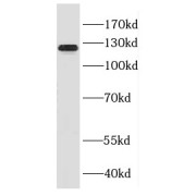 WB analysis of Jurkat cells, using DGCR8 C-terminal antibody (1/800 dilution).