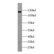 WB analysis of K-562 cells, using DGCR8 antibody (1/1000 dilution).