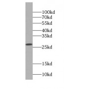WB analysis of mouse kidney tissue, using DGUOK antibody (1/300 dilution).